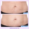 GoPure Tighten & Smooth Belly Cream