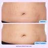 GoPure Tighten & Smooth Belly Cream